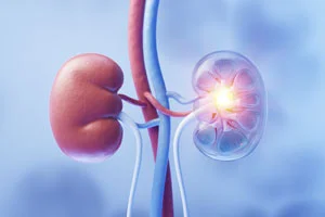 Nephrology Image